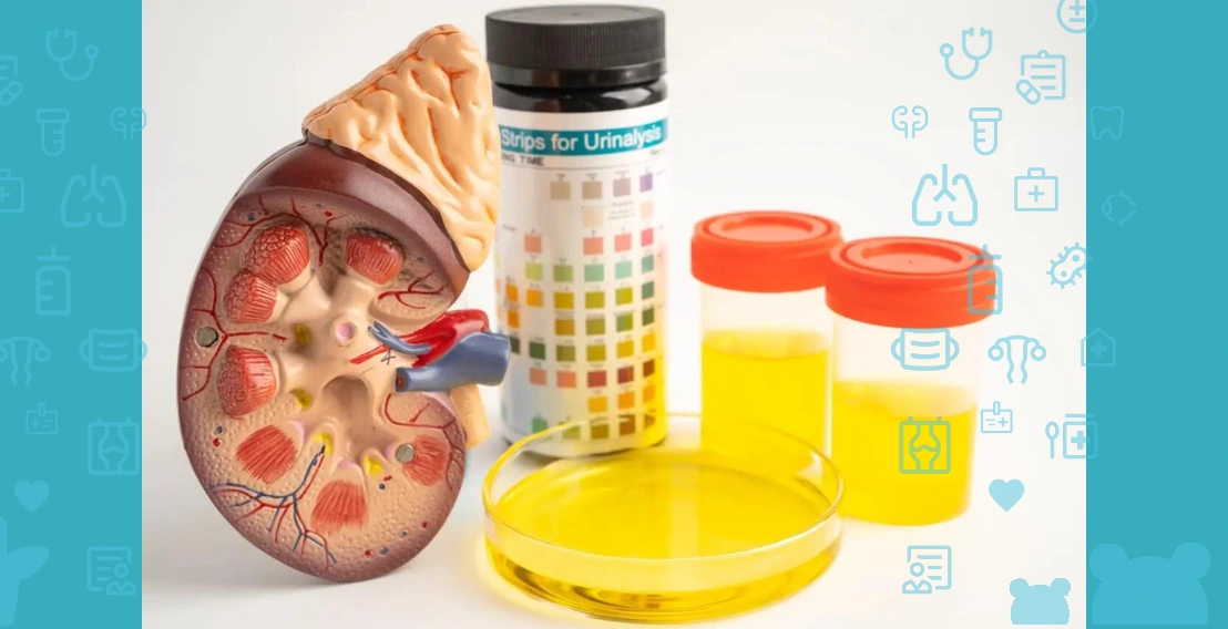 What does a complete urinalysis show?