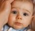 Stomatitis in children - causes, symptoms, treatment