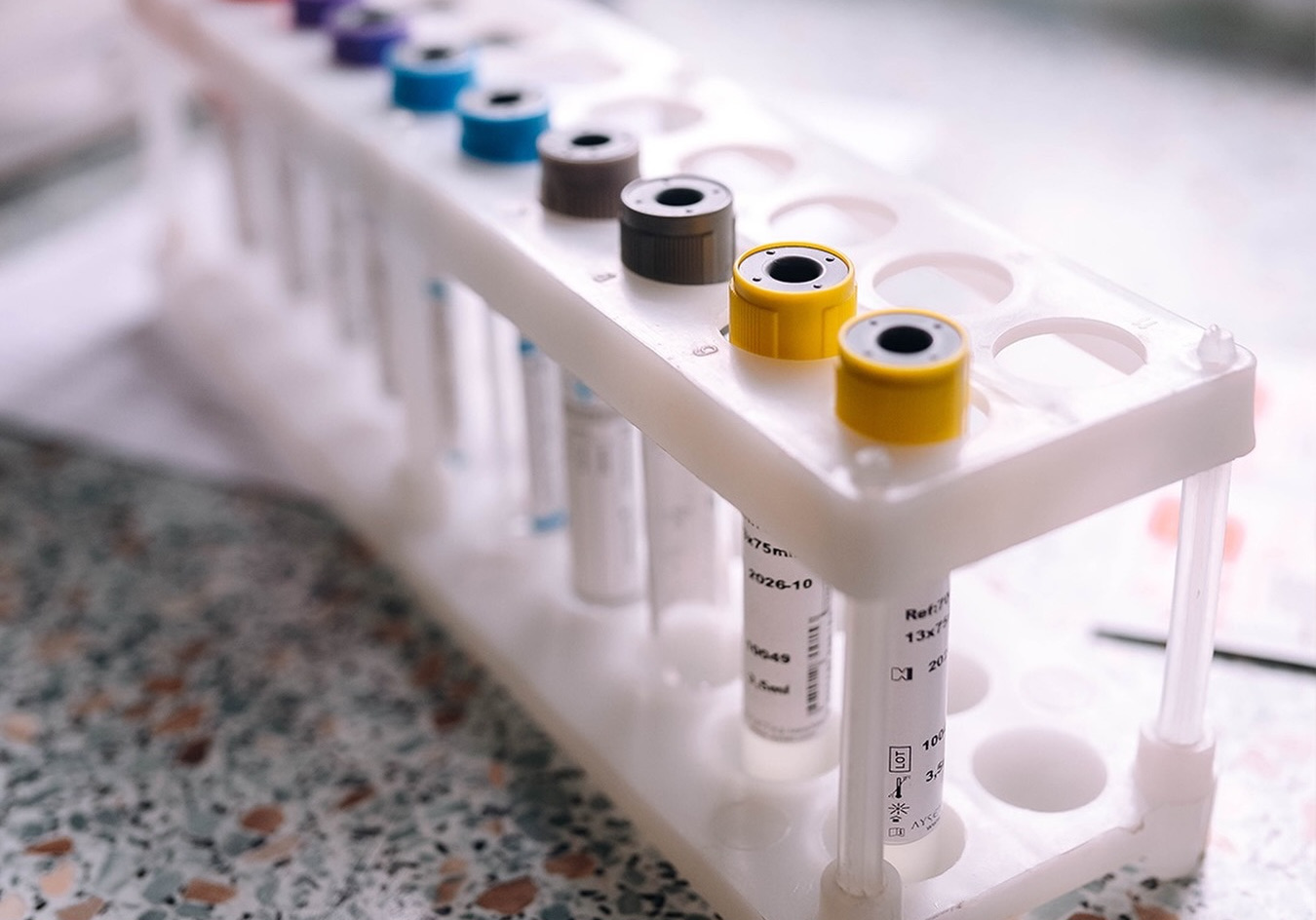 Аналіз крові на печінкові проби