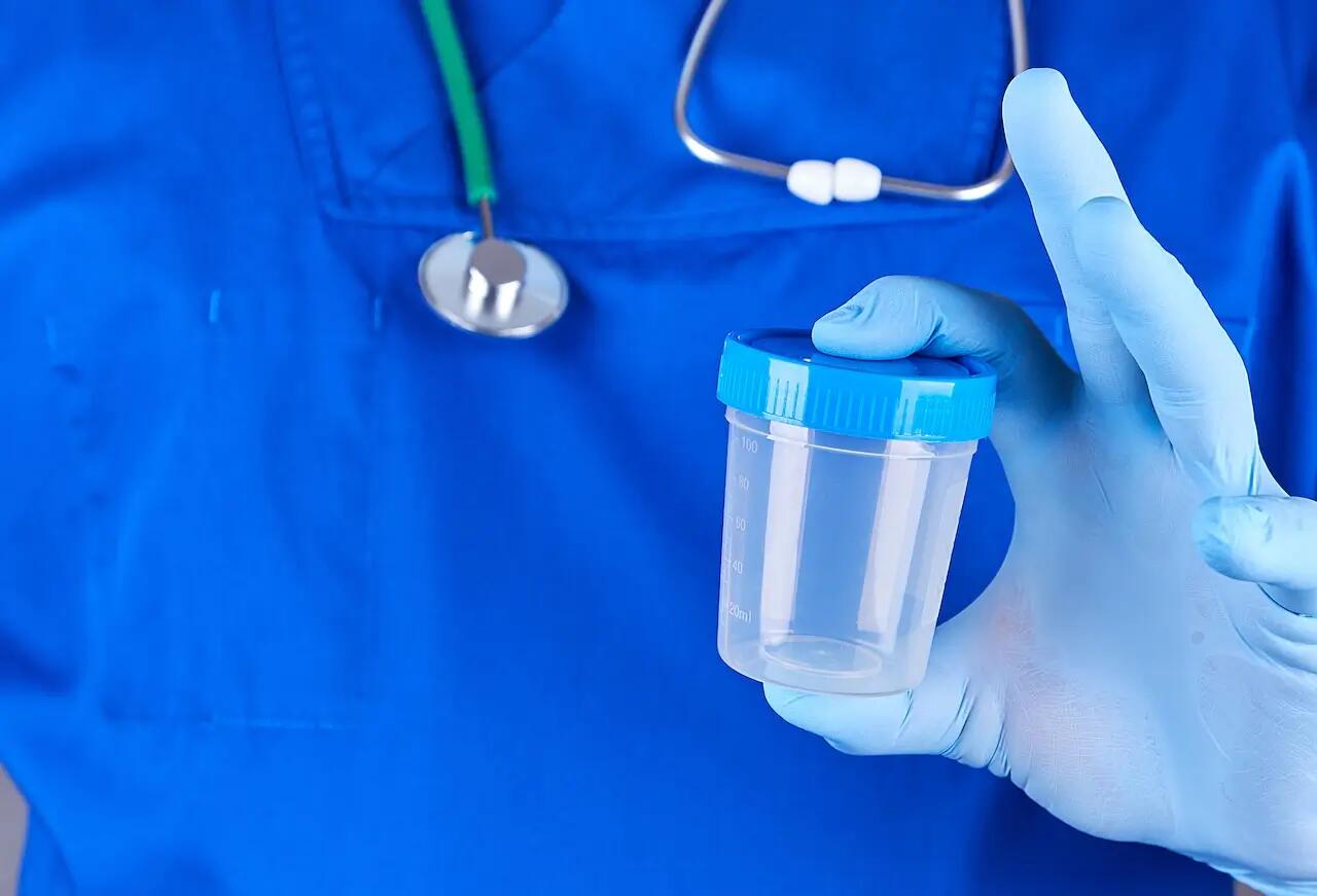 Копрограма: що показує аналіз калу та як правильно зібрати матеріал