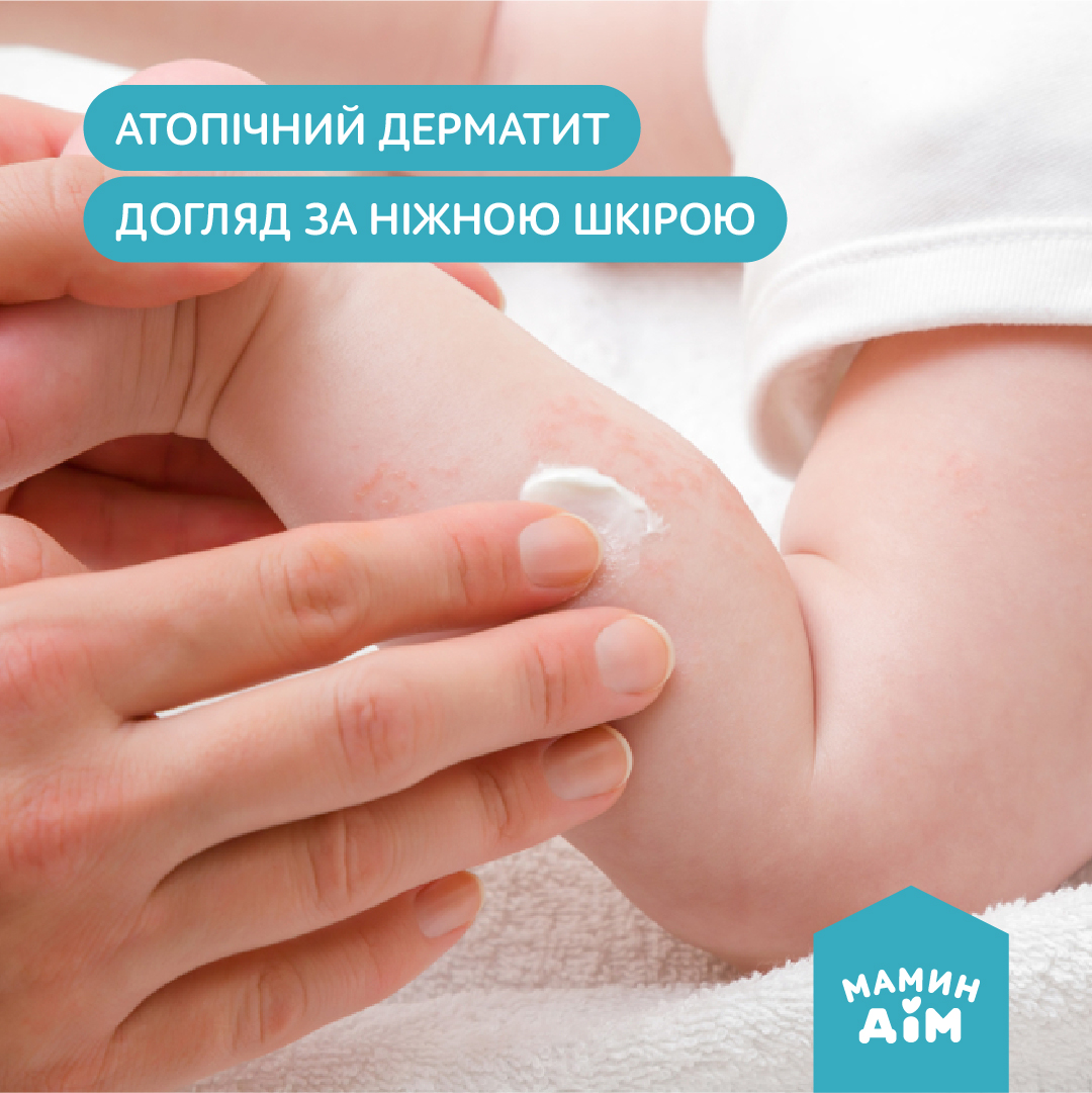 Atopic dermatitis, care for delicate skin