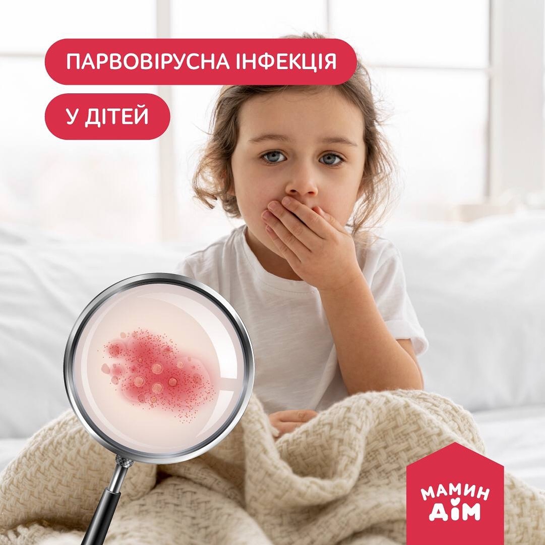 Парвовірусна інфекція у дітей  🤒