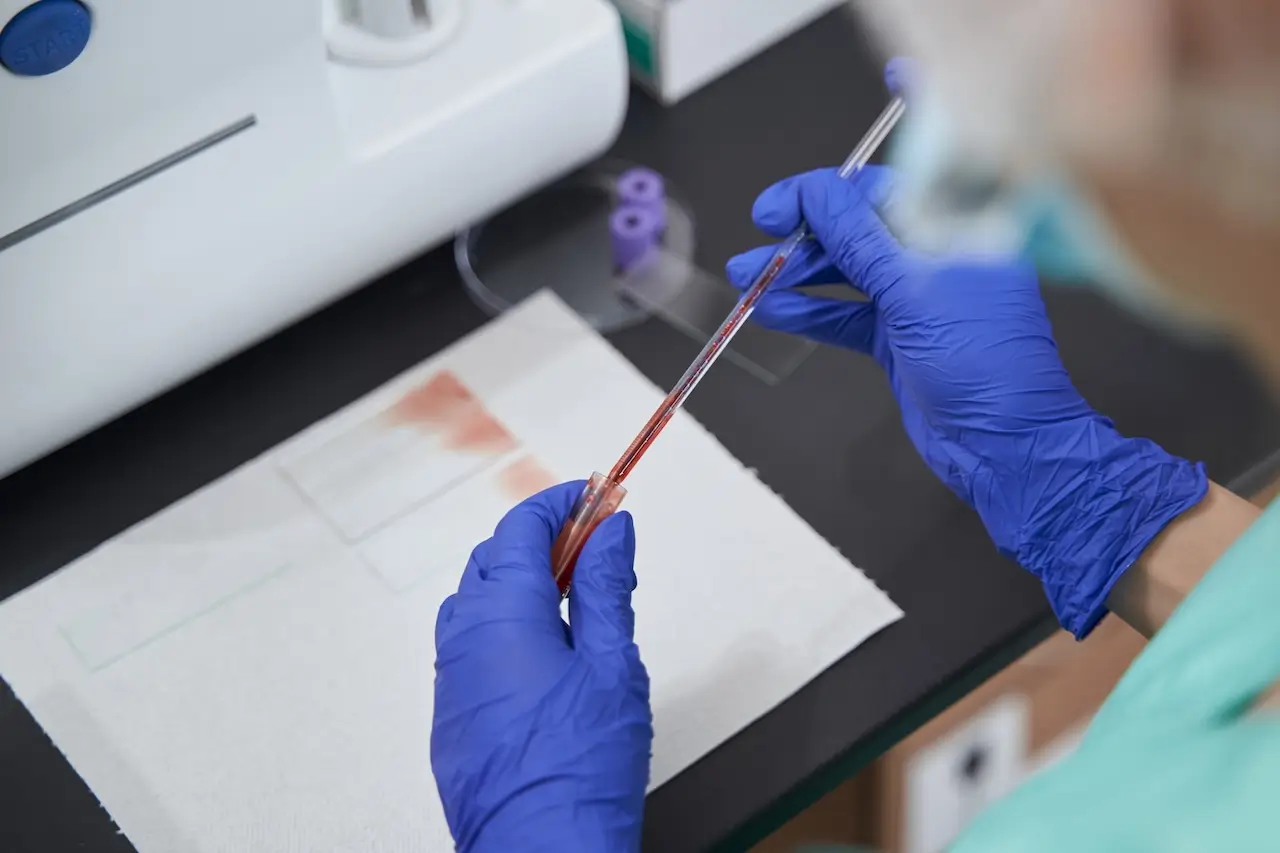 як часто потрібно складати аналізи на інфекції